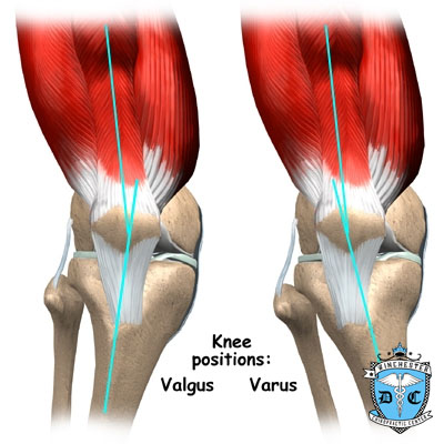 Illustration of knee positions.